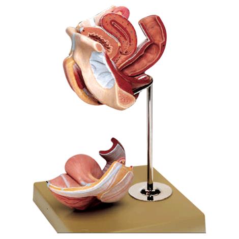 Anatomical Model of Female Genital Organs,7" x 7.5" x 10",Each,MS5