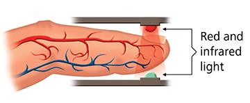 Pulse Oximeters