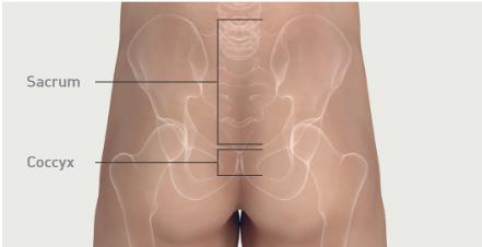 Mepilex_border_sacrum_application