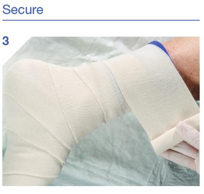 Hydrofera_blue_ready_application