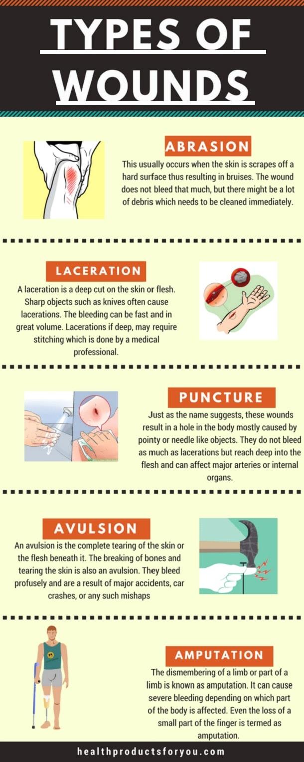 Types Of Wounds Laceration