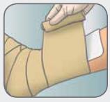 Mepilex_foam_dressing_application