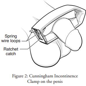 Using Bard Cunningham Clamp