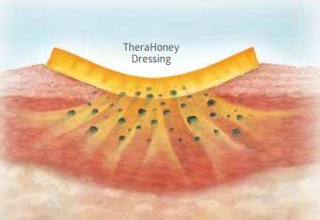 How does Therahoney Gel work?