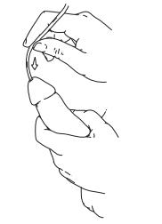 Male Intermittent Self-Catheterization