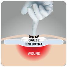 Buy Enluxtra Smart Wound Dressing [Self-Adaptive Dressing]