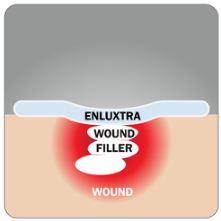 Buy Enluxtra Smart Wound Dressing [Self-Adaptive Dressing]