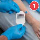 How to Apply Allegiance Transparent Film Dressing?