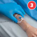 How to Apply Allegiance Transparent Film Dressing?