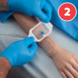 How to Apply Allegiance Transparent Film Dressing?